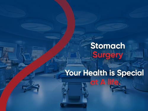 Stomach Surgery (Gastrectomy)